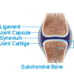 The Subchondroplasty® (SCP®) Procedure